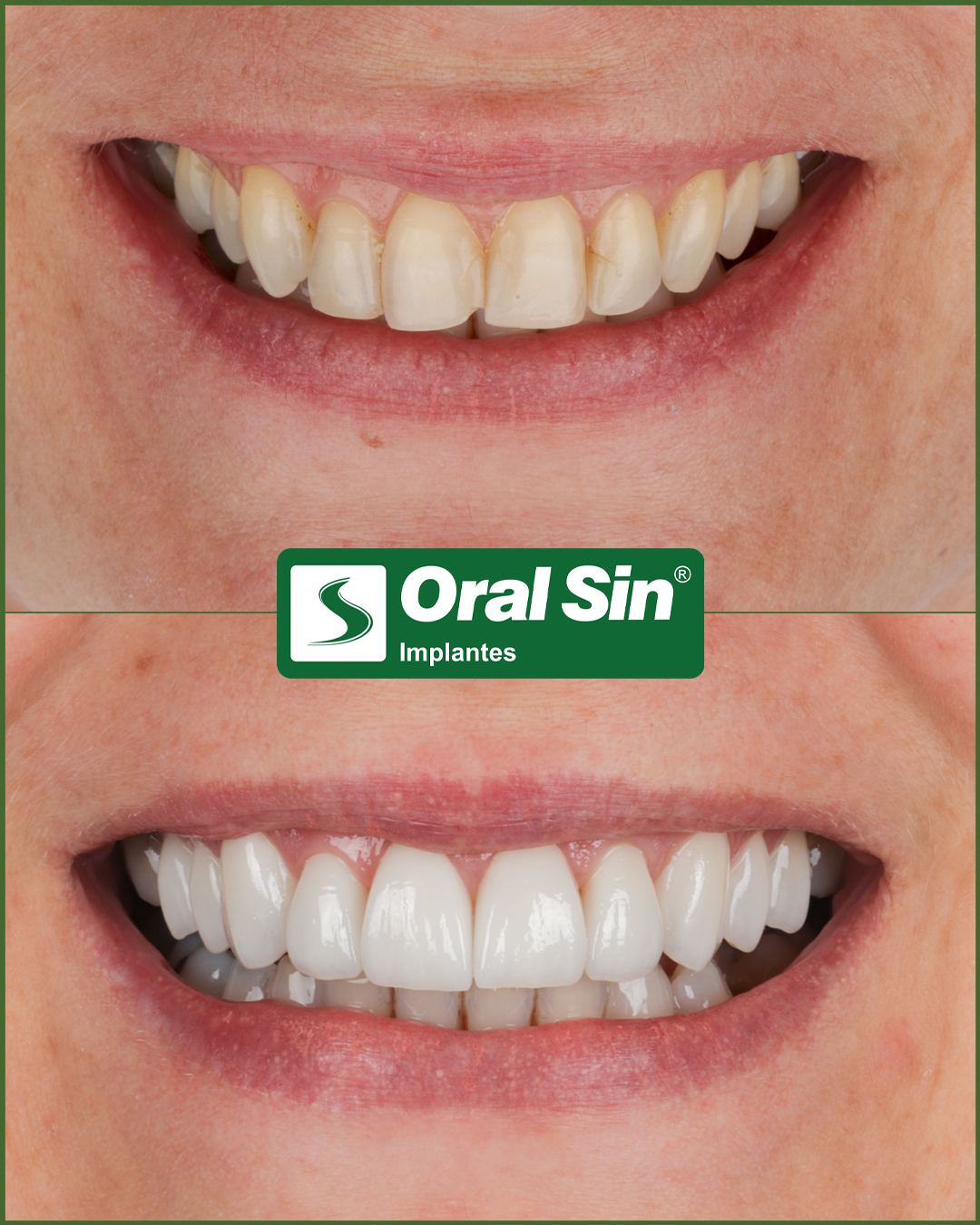 AD-Roseli-Schneiders-2